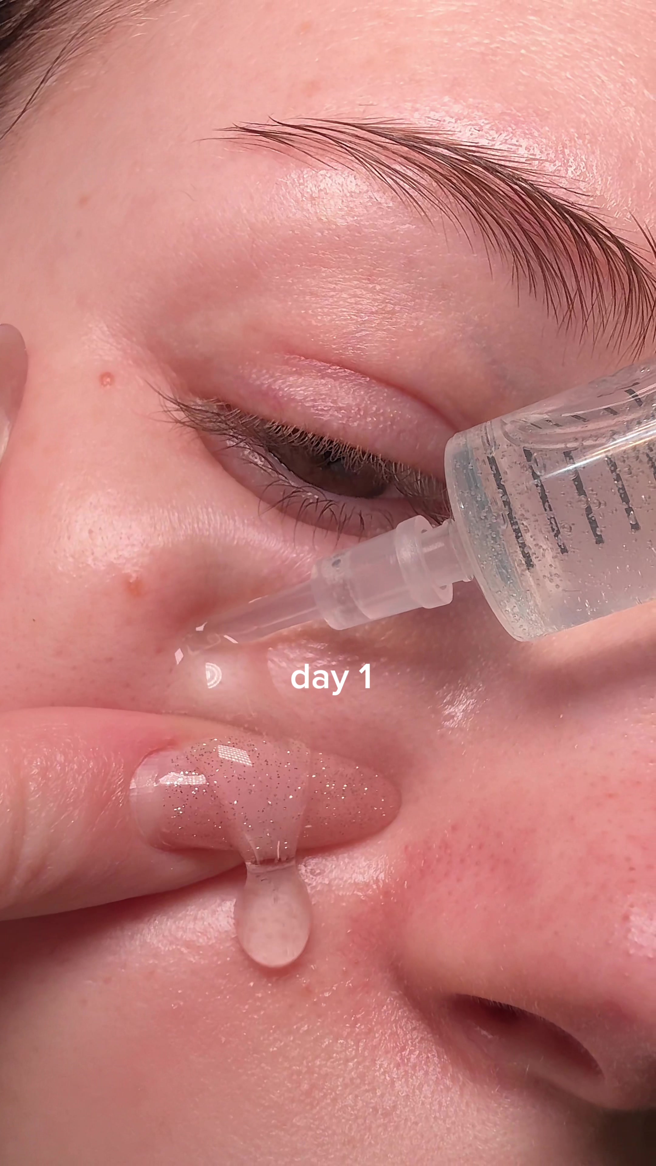 TikTok post by @what_is_lada for Torriden. Caption reads: [...] dehydrated skin first — this actually....