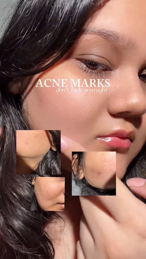 Instagram post by @thisisnotshyy for Dot & Key Skincare. Caption reads: Dark spots need consistency, not overnight....