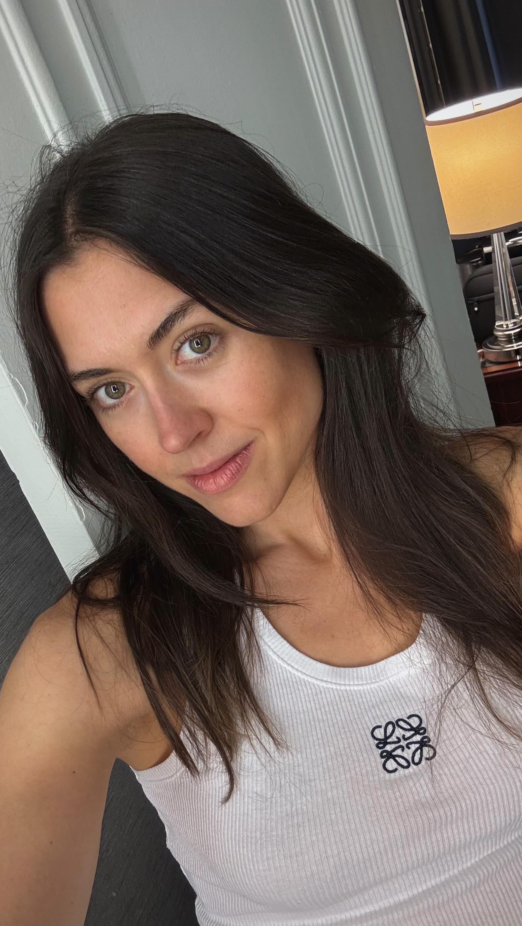 Instagram post by @toks_amy for Dots for Spots. Caption reads: [...] those annoying occasional pimples....