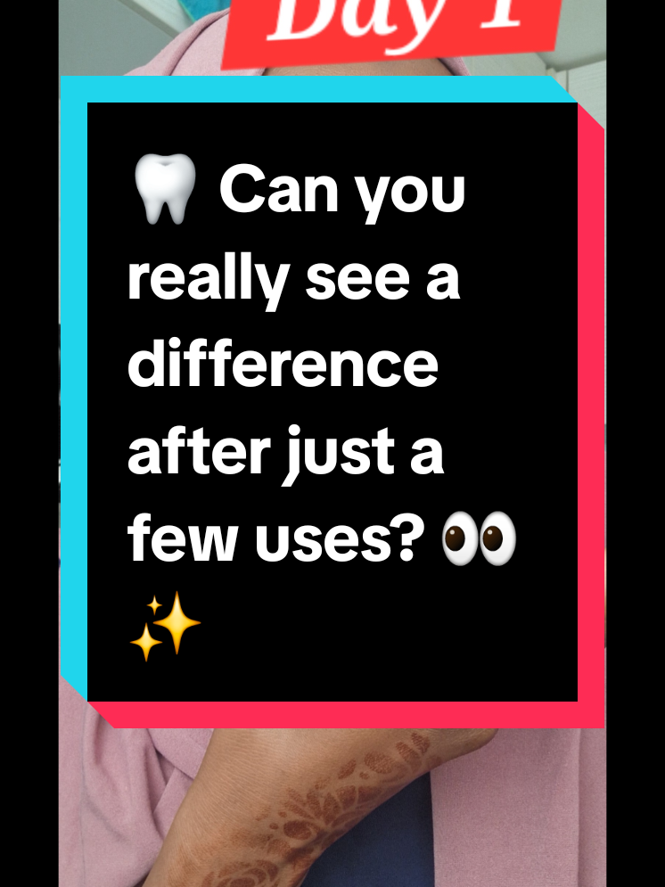 TikTok post by @khadijahjabbie for Icy Bear Dental. Caption reads: [...] 👀✨ I've been testing the @Icy Bear Icy Bear....