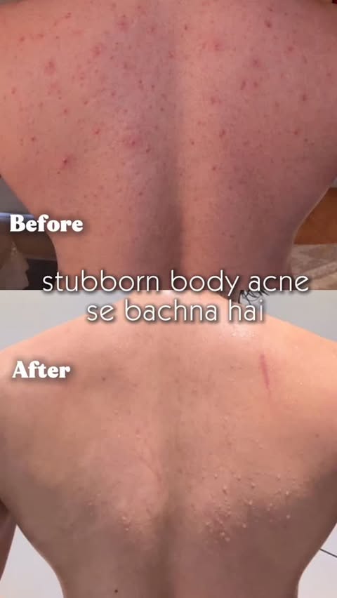 Instagram post by @anshsaini69 for Foxtale. Caption reads: [...] Don’t skip body care anymore....
