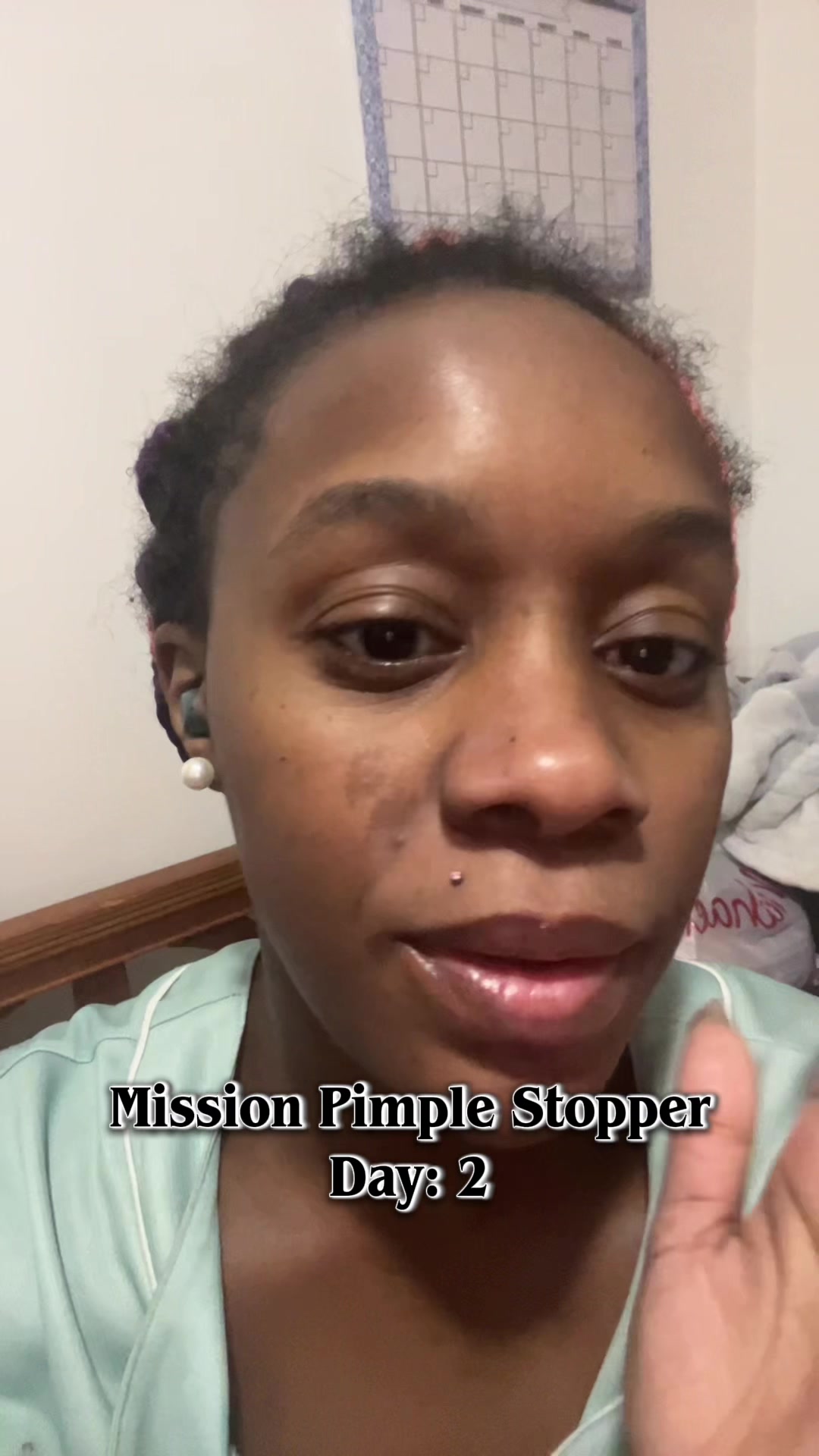 TikTok post by @bresomething for Kate Somerville. Caption reads: Day 2 using the @Kate Somerville acne treatment to....