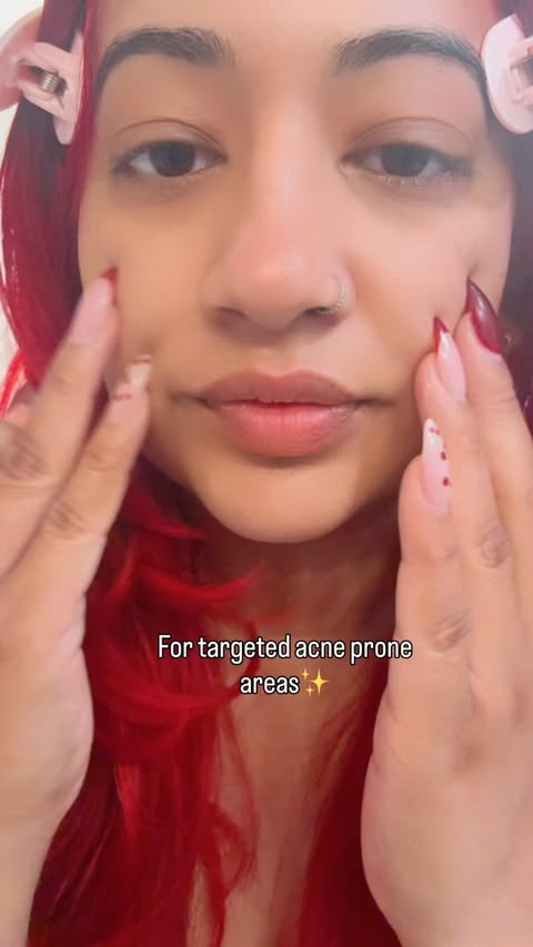 Instagram post by @magicaladventureswithsasha for Bazzaal. Caption reads: Breakout prone skin days call for a simple....
