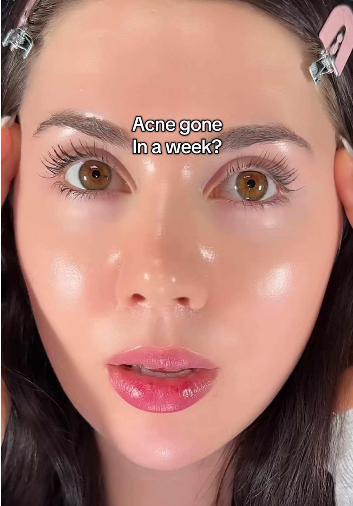 TikTok post by @itsedonna for Dr.G. Caption reads: [...] help… this cream saved it ❤️‍🩹 @Dr. G #drg....