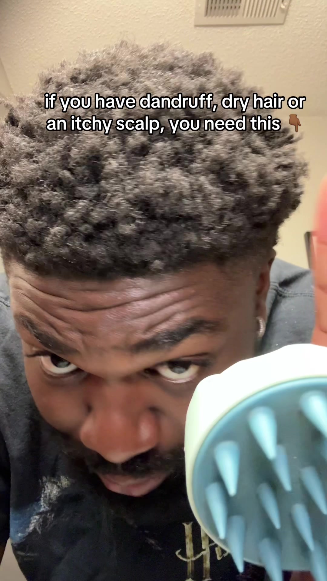 TikTok post by @colossusshops for artnaturals. Caption reads: fix that itchy scalp with @artnaturals ....