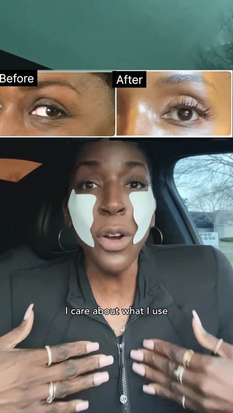 Instagram post by @hattie_willoughby7 for Anua. Caption reads: COMMENT 1 SEC for the ALL TIME LOWEST PRICE LINK. ....