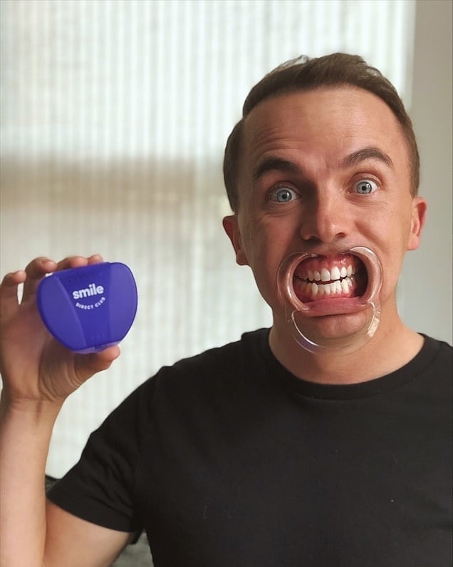 Instagram post by @frankiemuniz4 for SmileDirectClub. Caption reads: I have my wedding this month! That said, I have....