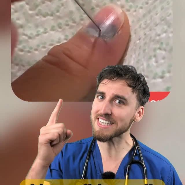 Instagram post by @dr_mattbarrett for Invideo. Caption reads: #ad Doctor explains painful subungal....