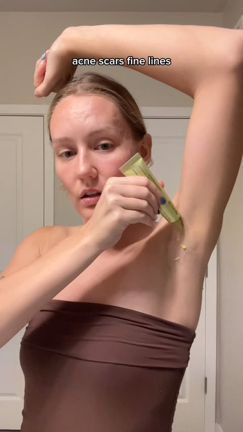 Instagram post by @theblemishqueen for goPure. Caption reads: I GET PIMPLES IN MY ARMPITS.. ANYONE ELSE???....