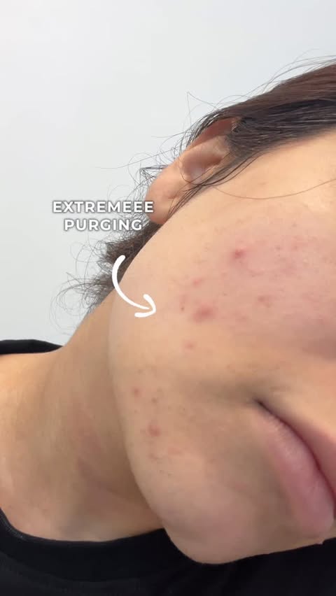 Instagram post by @simrann_sadh for Novology. Caption reads: [...] any others in the market🤭 it’s the Novology....