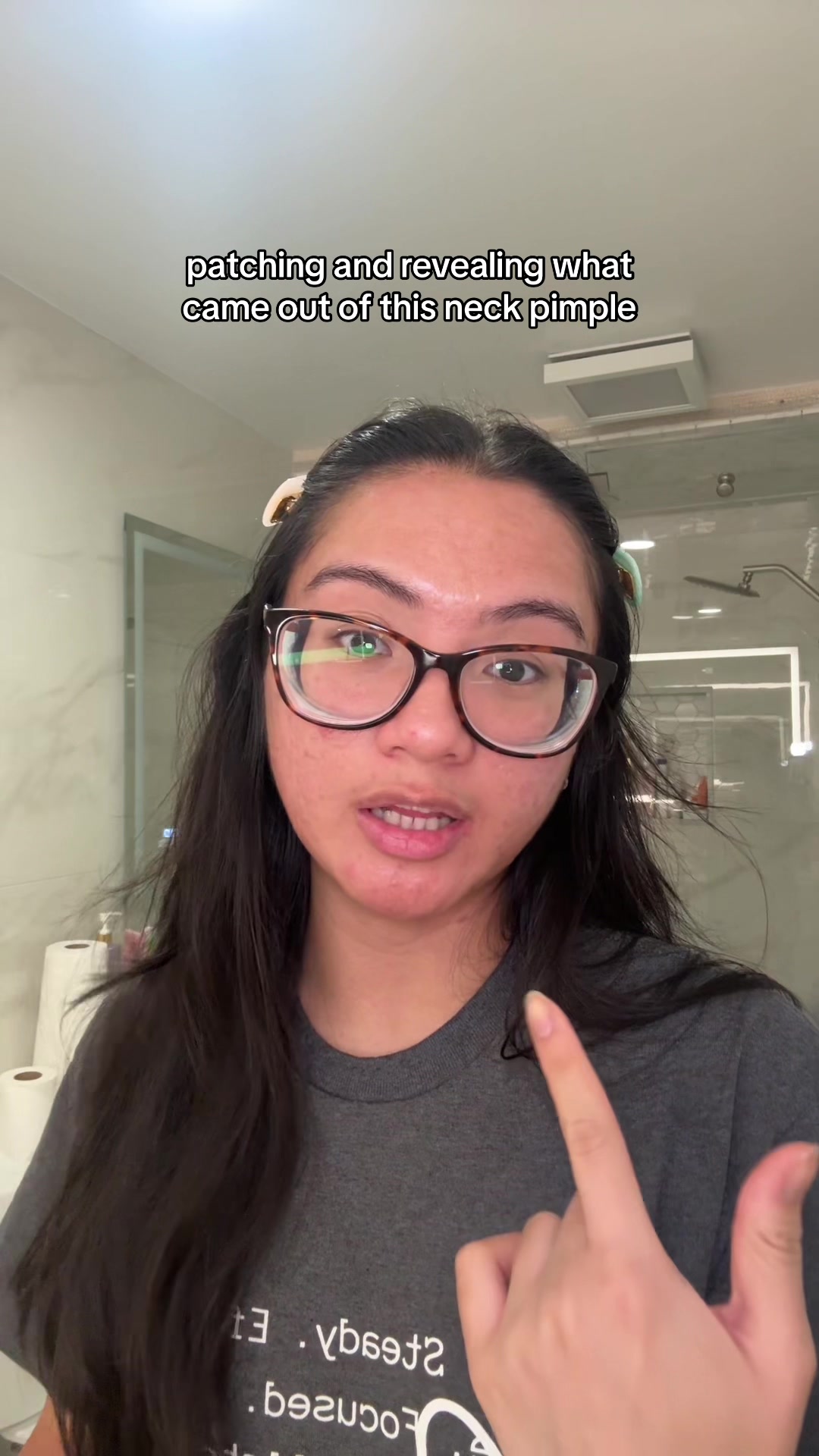 TikTok post by @jennileeashlee for Peace Out Skincare. Caption reads: the disrespect i felt when i found this pimple 😐....