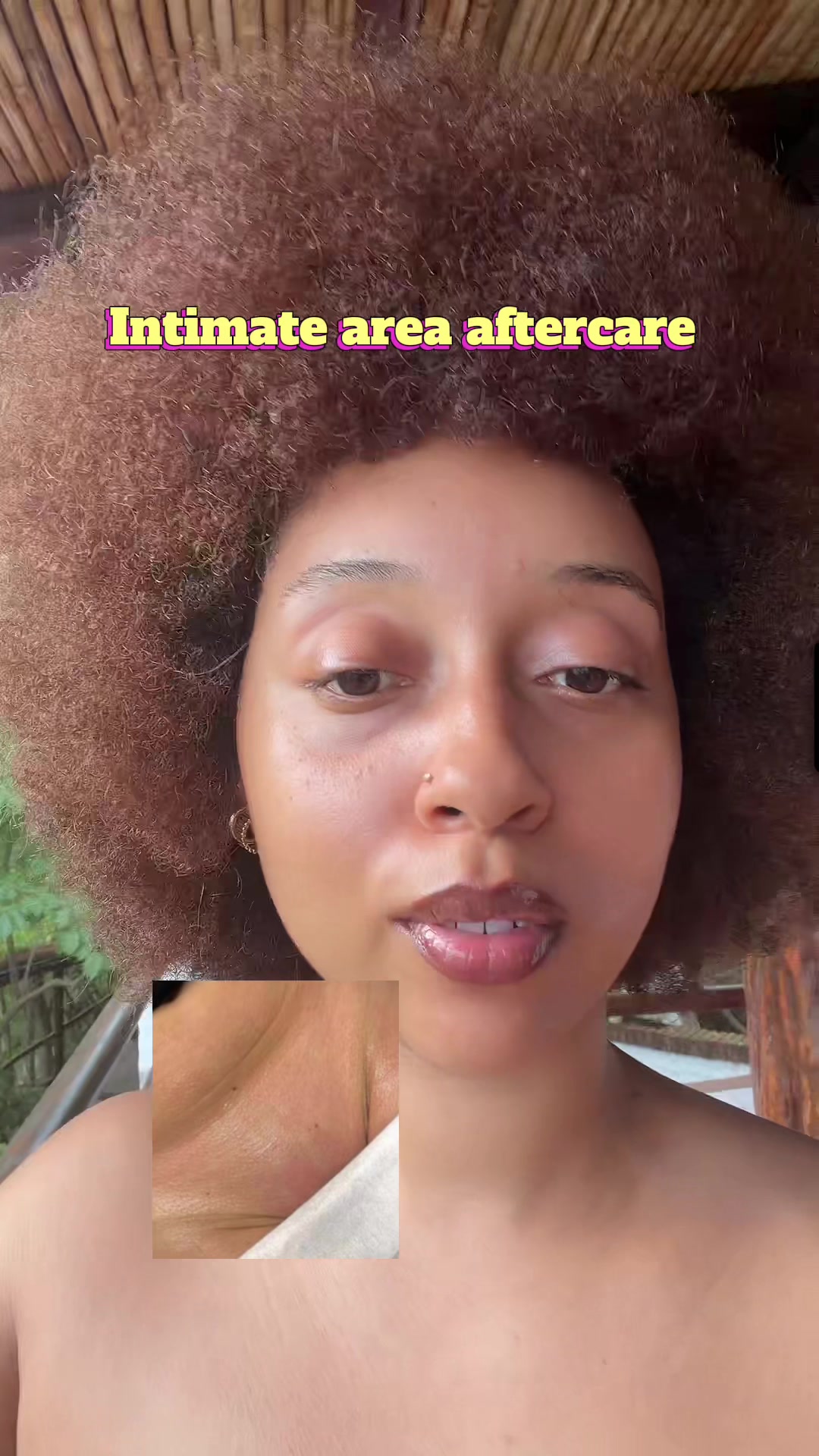 TikTok post by @theroyalcesarstm for Honey Glow. Caption reads: [...] ingrowns, marks and hyperpigmentation. Honey....
