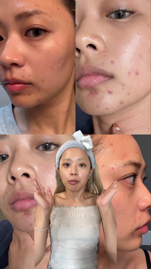 Instagram post by @menkyo__no__insta for Skin1004. Caption reads: おしゃれなパック発見！！！
シートのフィット感も良すぎる、、、🥹🤍
@skin1004_japa....