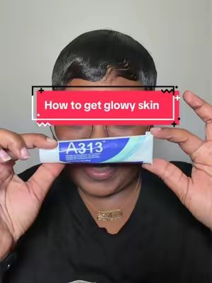 TikTok post by @itsstephanielynnn for French Pharmacy. Caption reads: [...] hyperpigmentation A313 from @FrenchPharmacy....