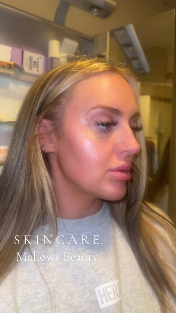 TikTok post by @digitalendo.diary for Mallows Beauty. Caption reads: [...] Check out the glow after using....