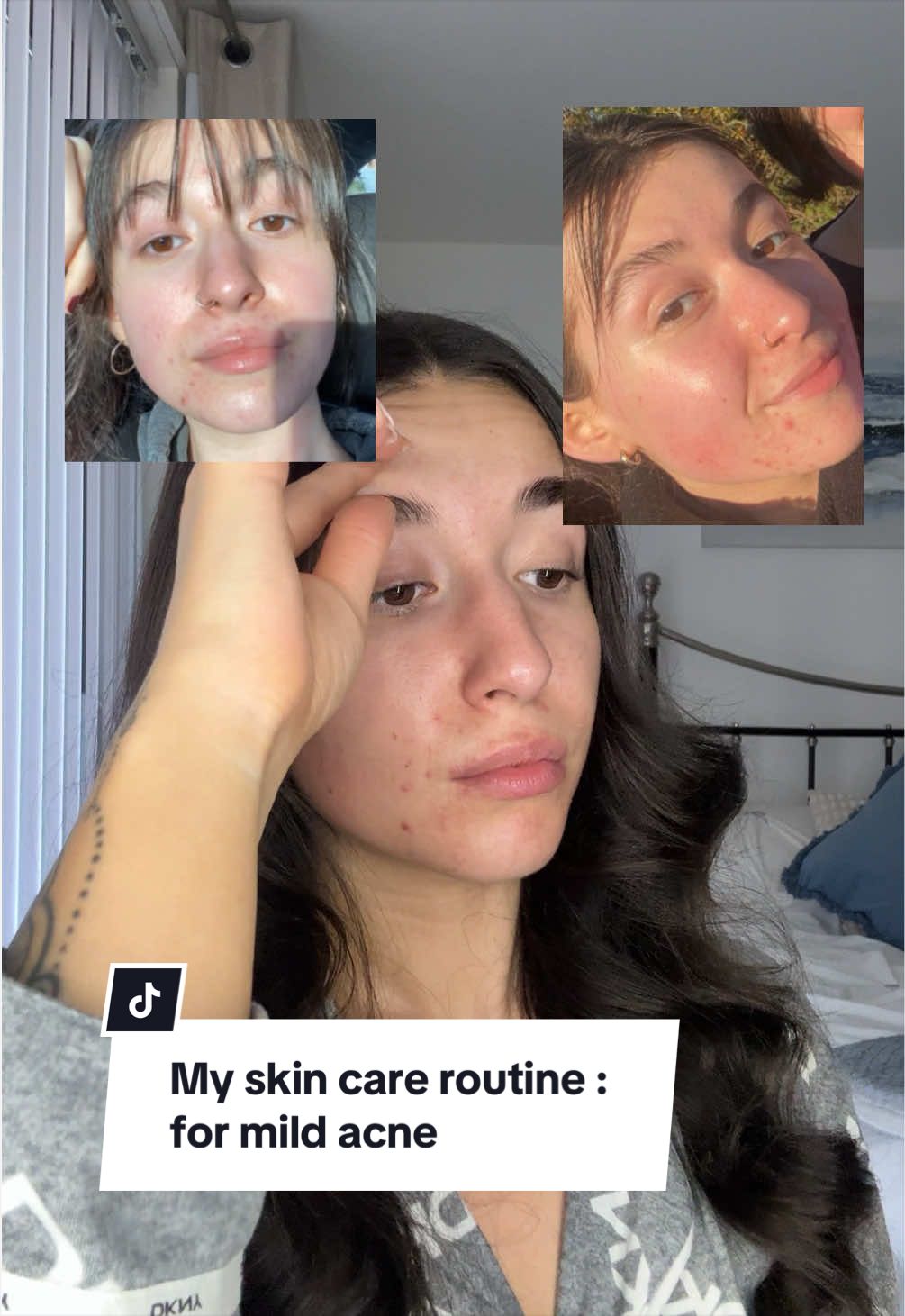 TikTok post by @gainswithgrace__ for Kanzen Skincare. Caption reads: [...] #mildacne #acne #skincareroutine @Kanzen....
