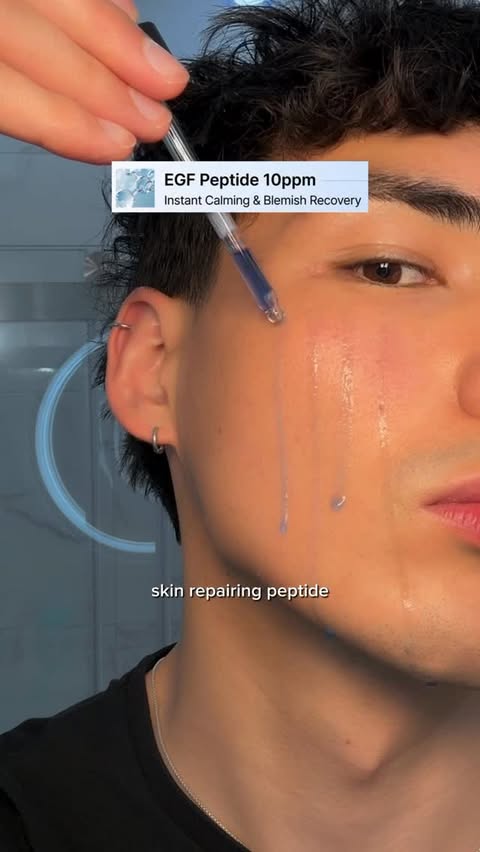 Instagram post by @unfollowadrian for Dear, Klairs US. Caption reads: The one serum that actually works for acne-prone....