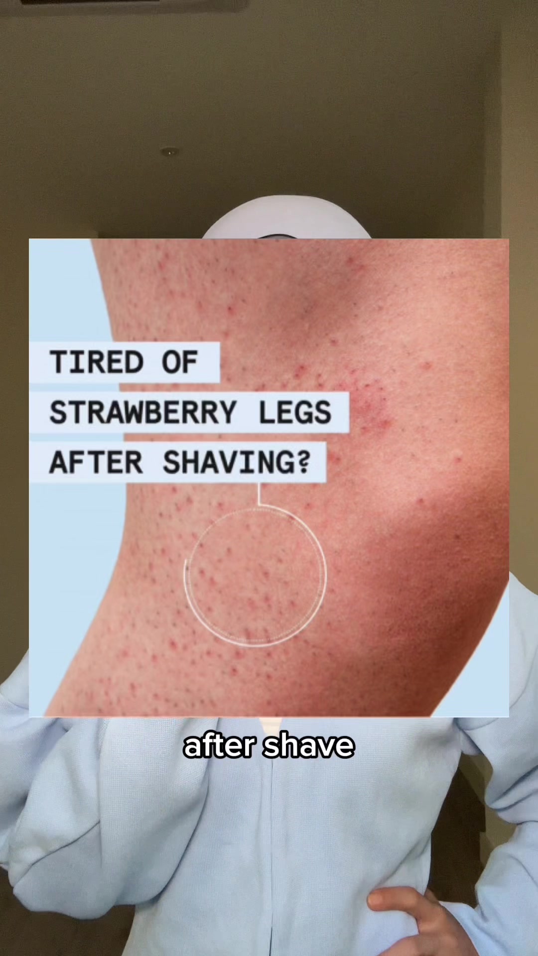 TikTok post by @sharifahroses for Gillette Venus. Caption reads: I’ve struggled with strawberry legs after shave....