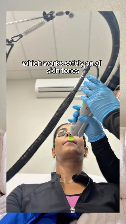 Instagram post by @doctor.naveena for Milan Laser Hair Removal. Caption reads: What laser hair removal CAN ✅ and CAN’T ❌ do....