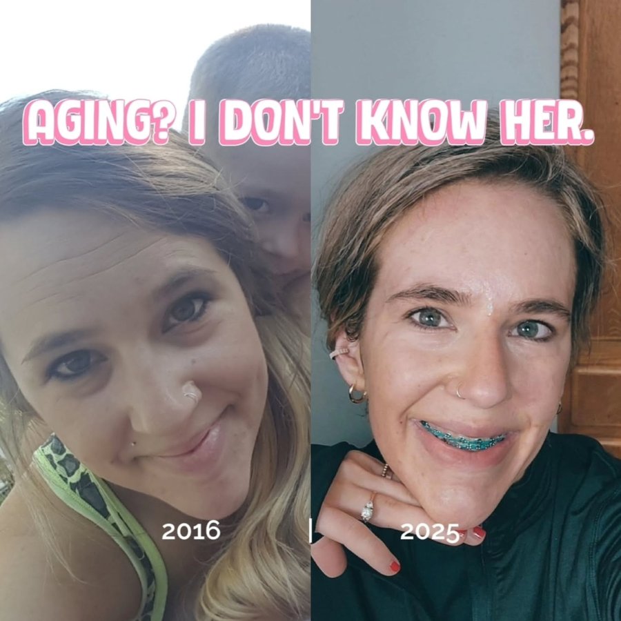 Instagram post by @rose.tuers for FROWNIES. Caption reads: [...] #NoBotoxNeeded #ConsistencyWins....