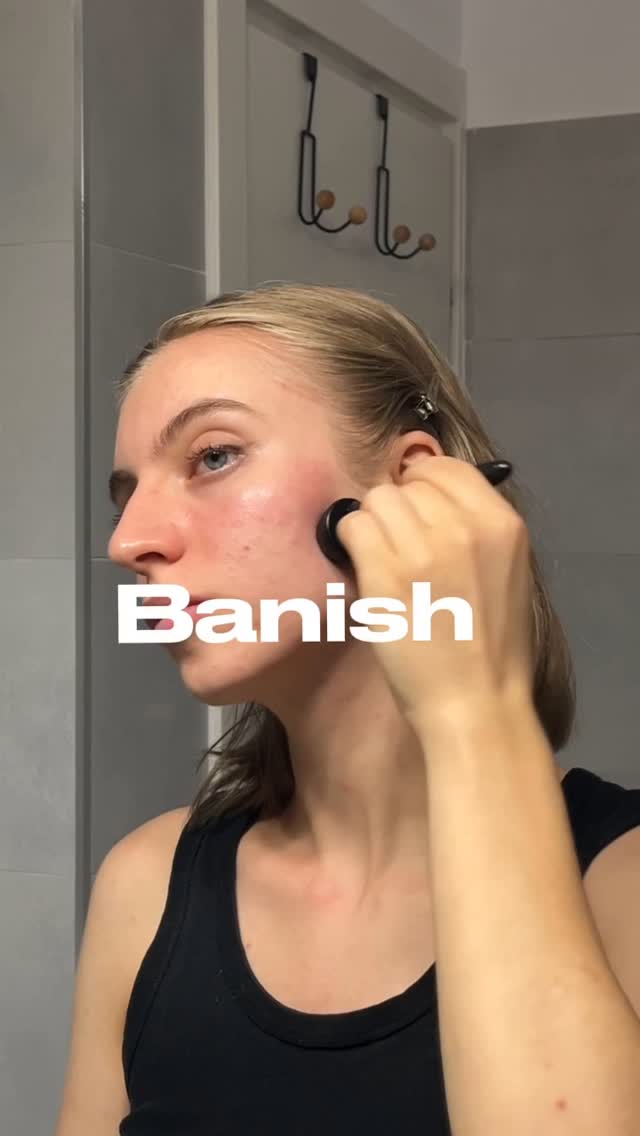 Instagram post by @ana_vaideanu for Banish. Caption reads: All those years of acne left me with scars.
That’s....