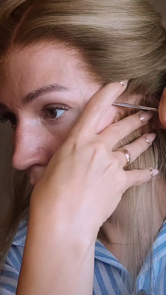 Instagram post by @emms_alopecian for BHBD. Caption reads: [...] result.💛 

.

Ad. This wig is from @bhbd ,....