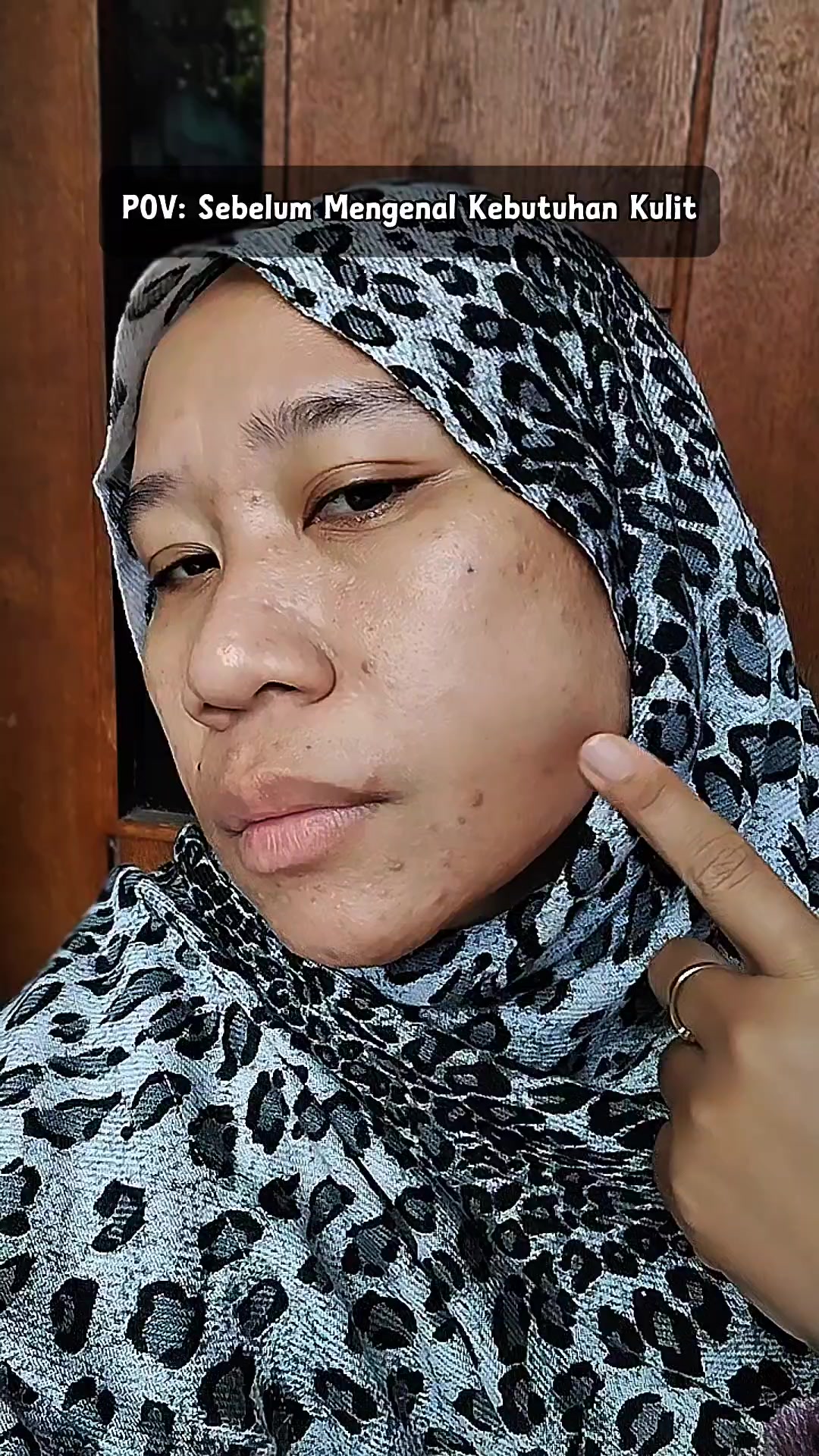 TikTok post by @meirayu2 for Kezia Beauty. Caption reads: [...] dan terlihat lebih sehat. Acne Series Kezia....