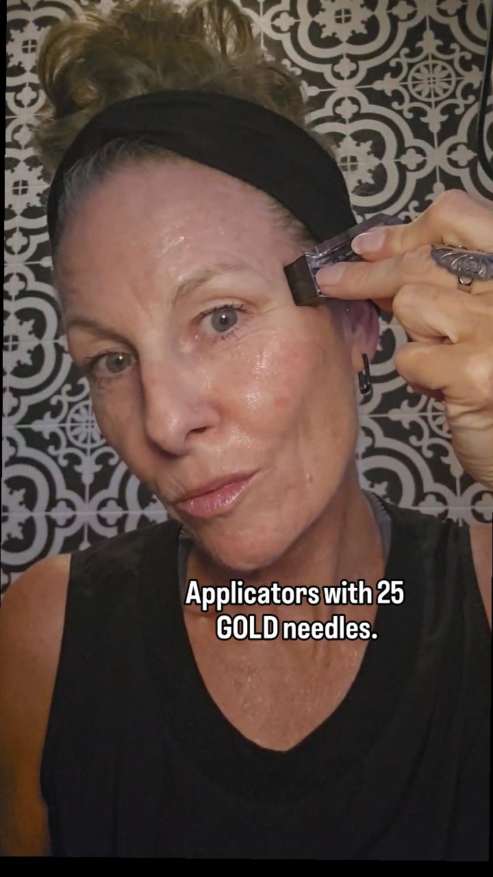 Instagram post by @kristen_amie for Homeso Care. Caption reads: Microneedling at home??😍✨️ Don’t mind if I do! 👌....