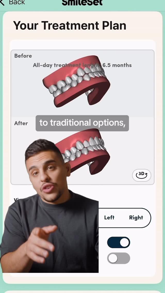 Instagram post by @camachooo for SmileDirectClub. Caption reads: #ad Can’t believe I just scanned my teeth at home…....