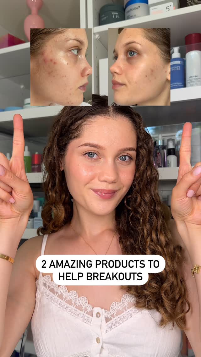 Instagram post by @sparklesandskin for Facetheory. Caption reads: 2 amazing products to help breakouts....