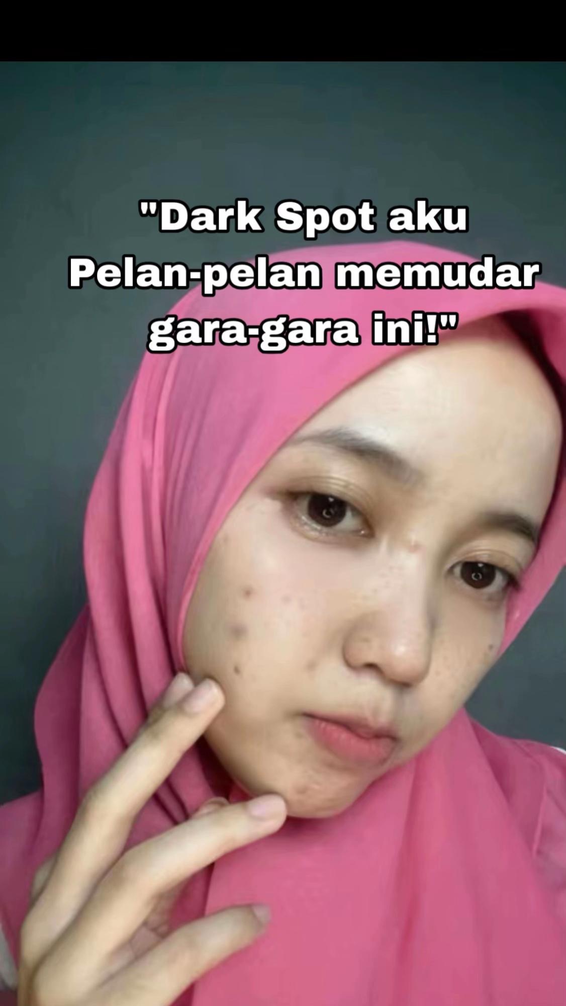 TikTok post by @bunga_sun0 for Glow & Lovely Arabia. Caption reads: Capek banget sama noda hitam yang ga....