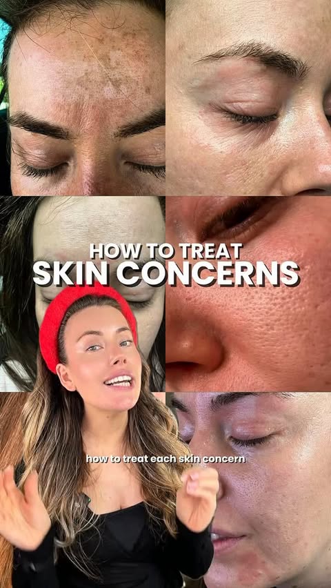 Instagram post by @glowforyourskins for COSRX. Caption reads: [...] Enlarged pores AM - Niacinamide serum....