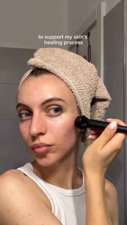 Instagram post by @ana_vaideanu for Banish. Caption reads: I use the Banisher 3.0 as part of my skin-healing....