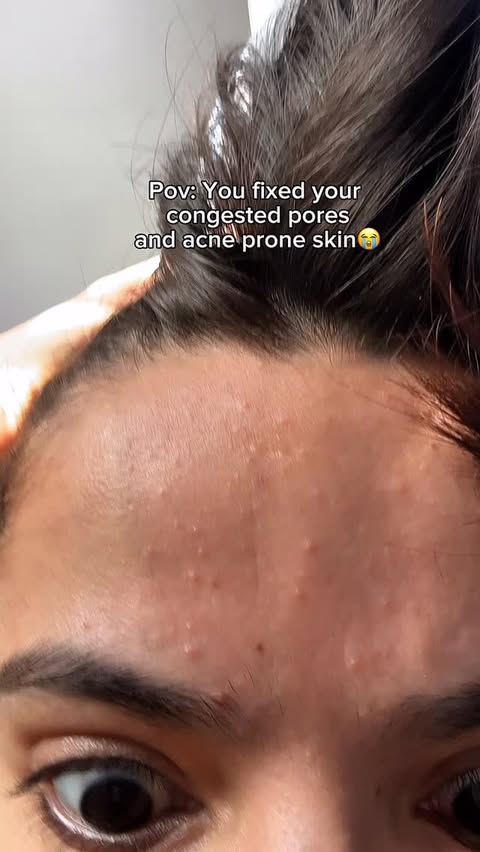 Instagram post by @vivinaveee for Foxtale. Caption reads: [...] skin and thank me later 🤏🏻✨ #Foxtale....
