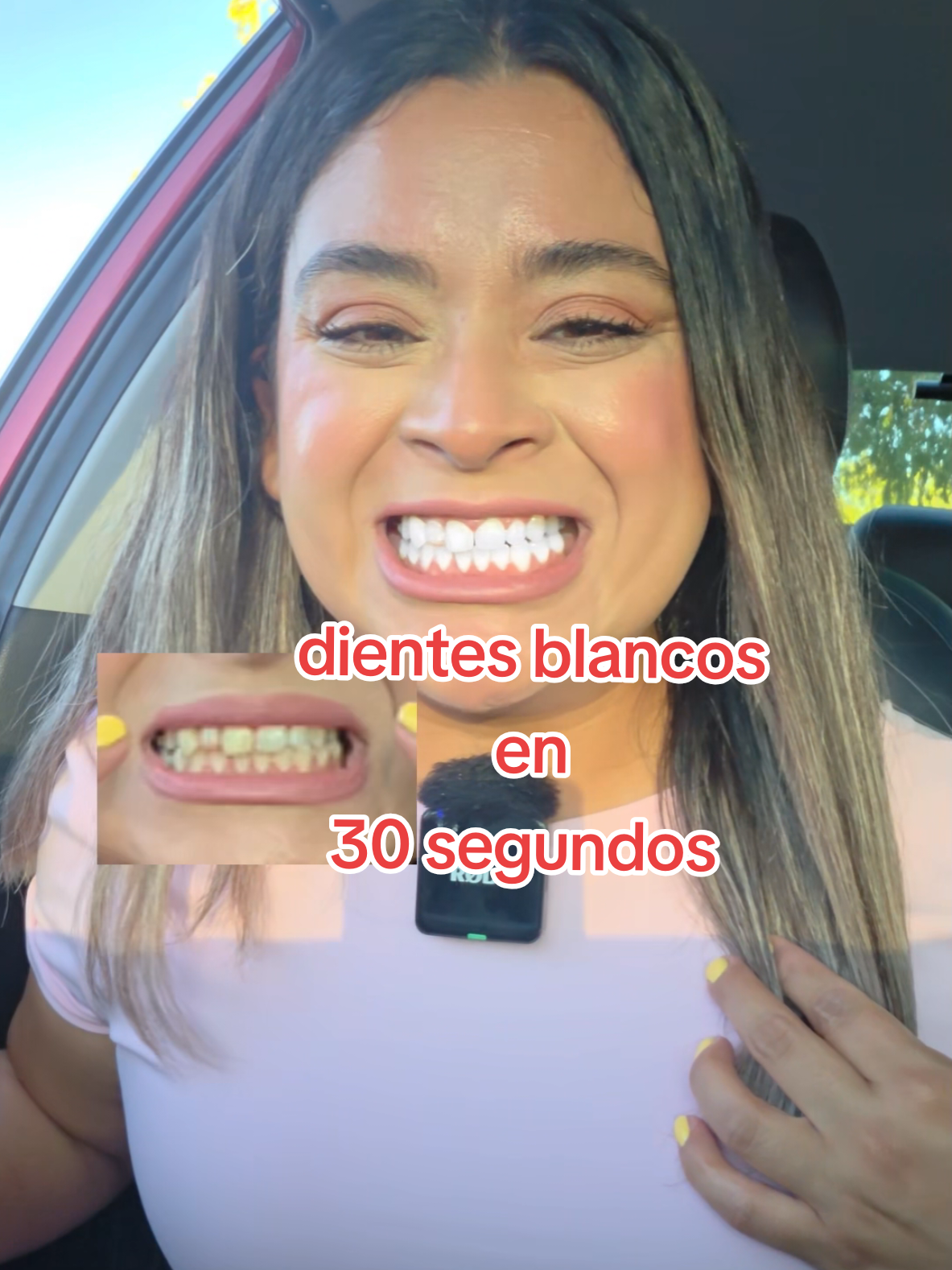 TikTok post by @zardeloscupones for Bodyaccel. Caption reads: enjuage bucal para blancar dientes @BodyAccel US....