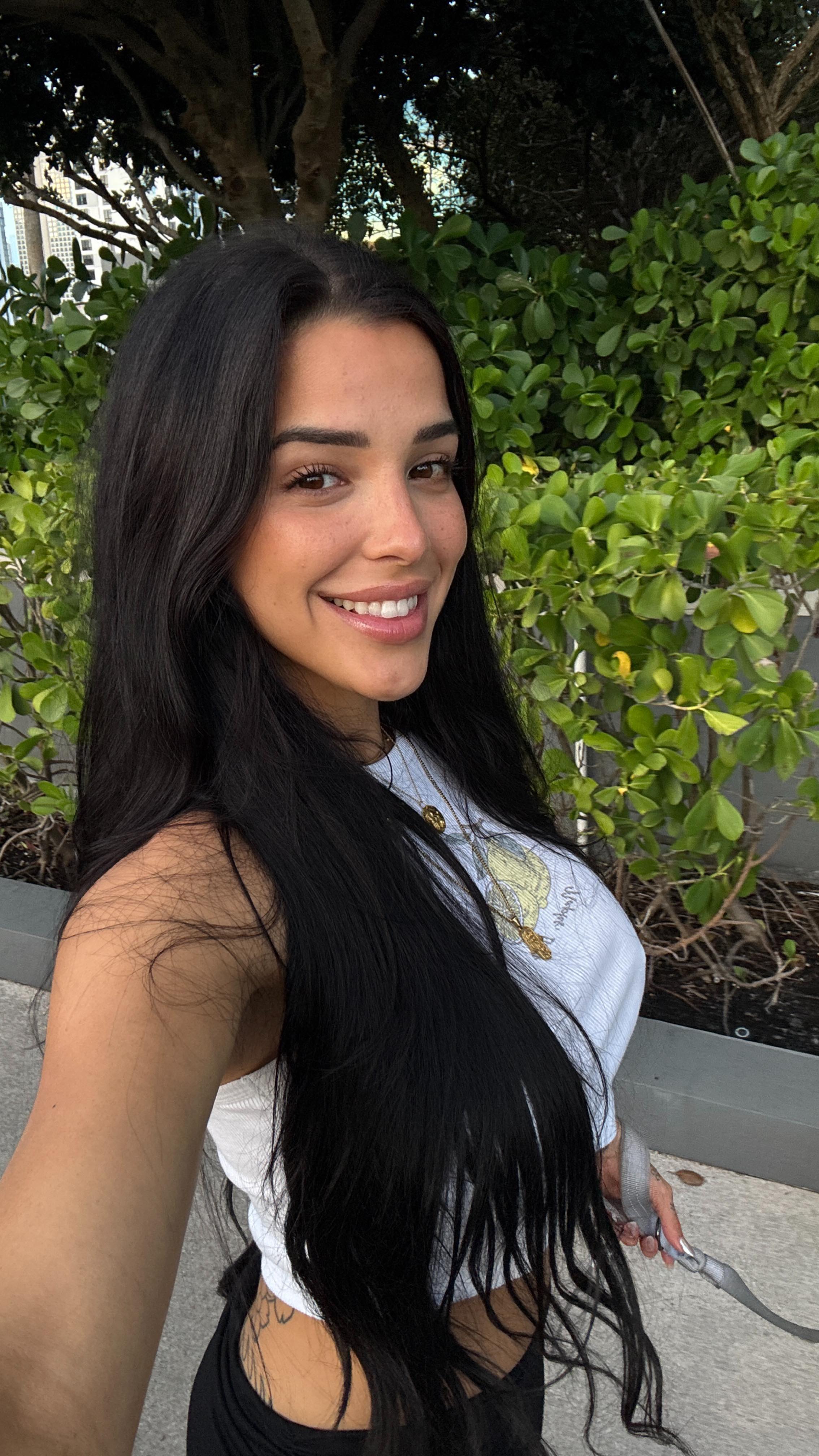 Instagram post by @valebragg for Removery. Caption reads: The start of my tattoo removal journey ❤️....