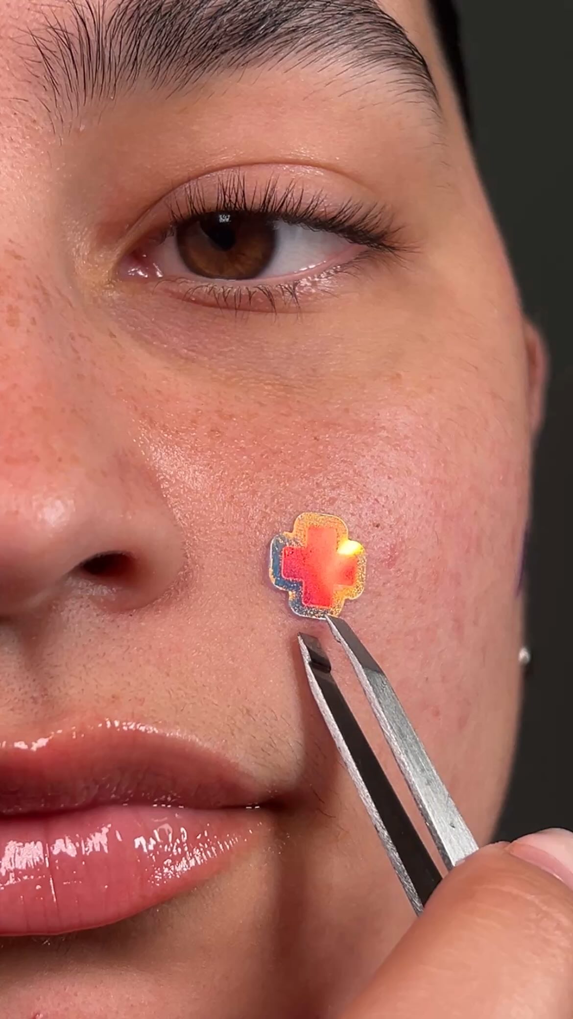 Instagram post by @rubysacne for Dr Idriss. Caption reads: [...] dark spots they leave behind 🙂‍↕️💜....