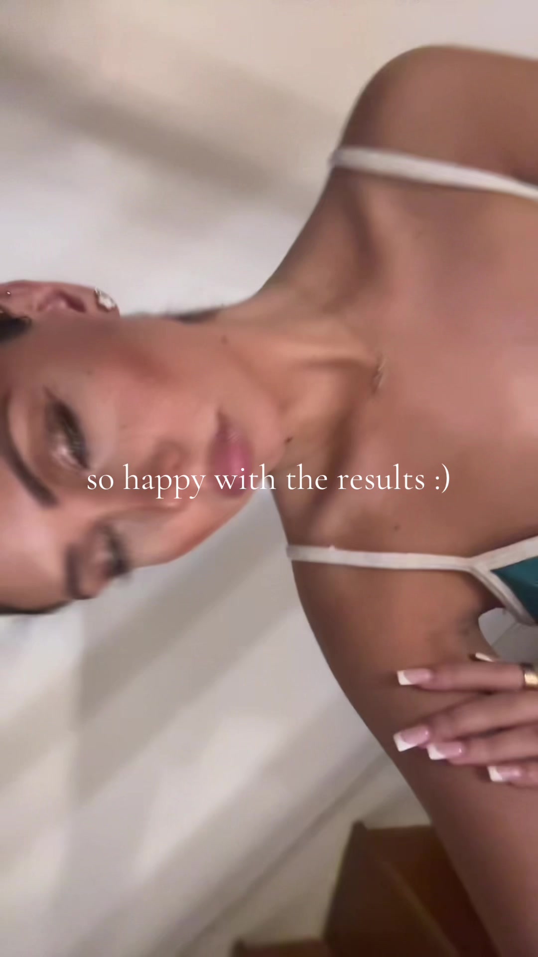 TikTok post by @yasmin.ri for EC Clinic London. Caption reads: waxed my face and that unfortunately gave me an....