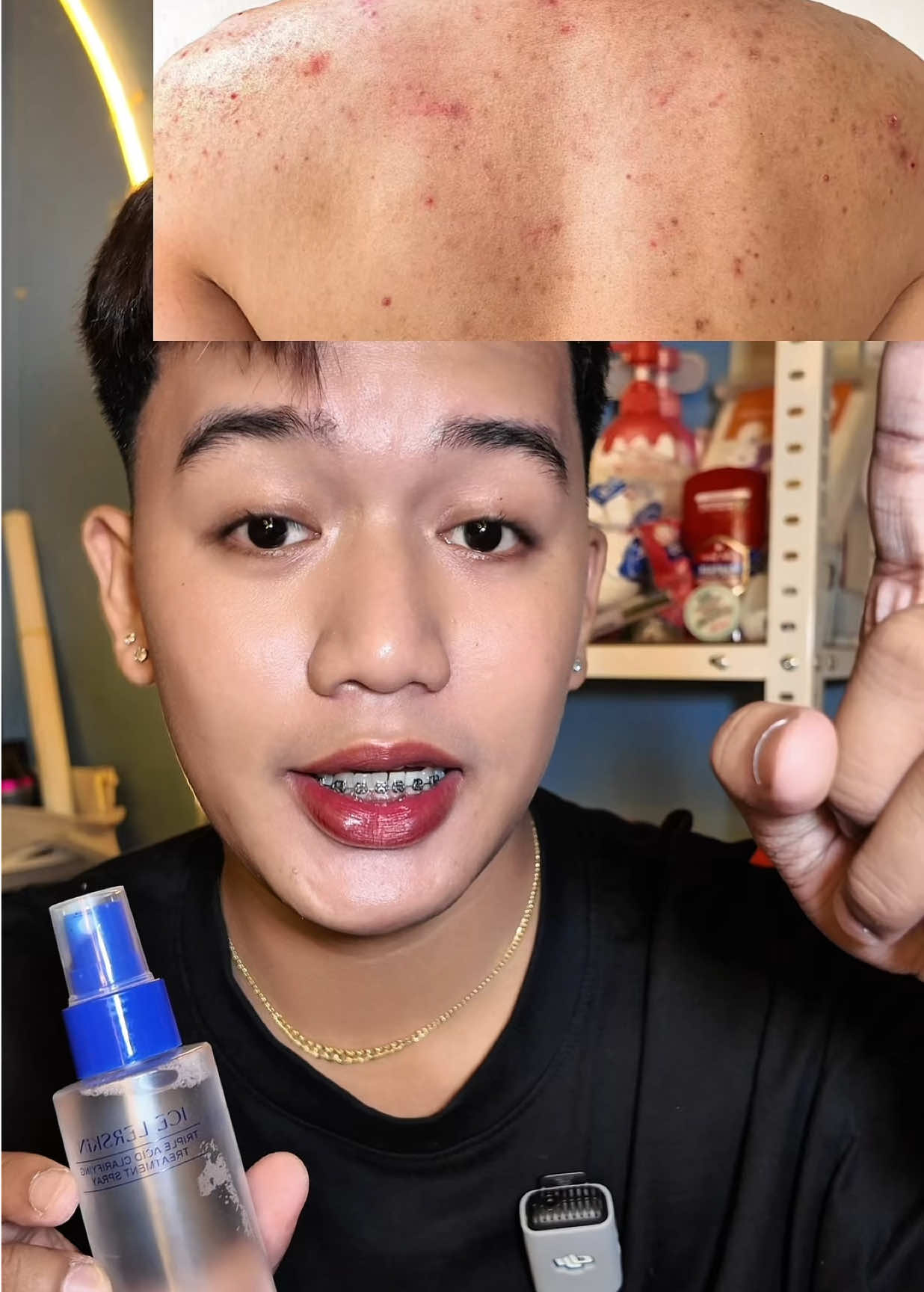 TikTok post by @iam_gelopatungan for ICE LERSKIN. Caption reads: [...] the solution! Try nyo na tong bago ng....