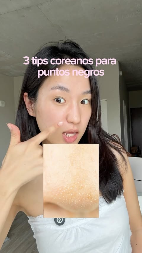 Instagram post by @kelly.coreana for ilso. Caption reads: [...] puntos negros! son filaments sebaceous....