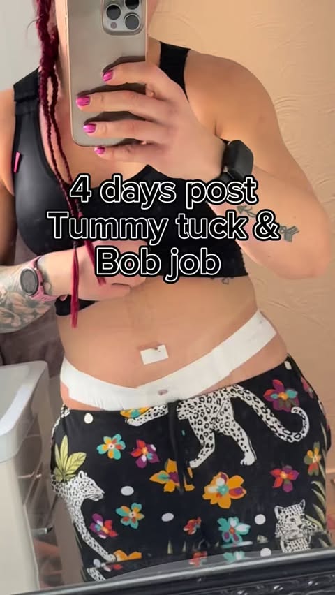 Instagram post by @iam_nbfitness for Esn. Caption reads: 4 days post tummy tuck and bob job! 

Not gonna....