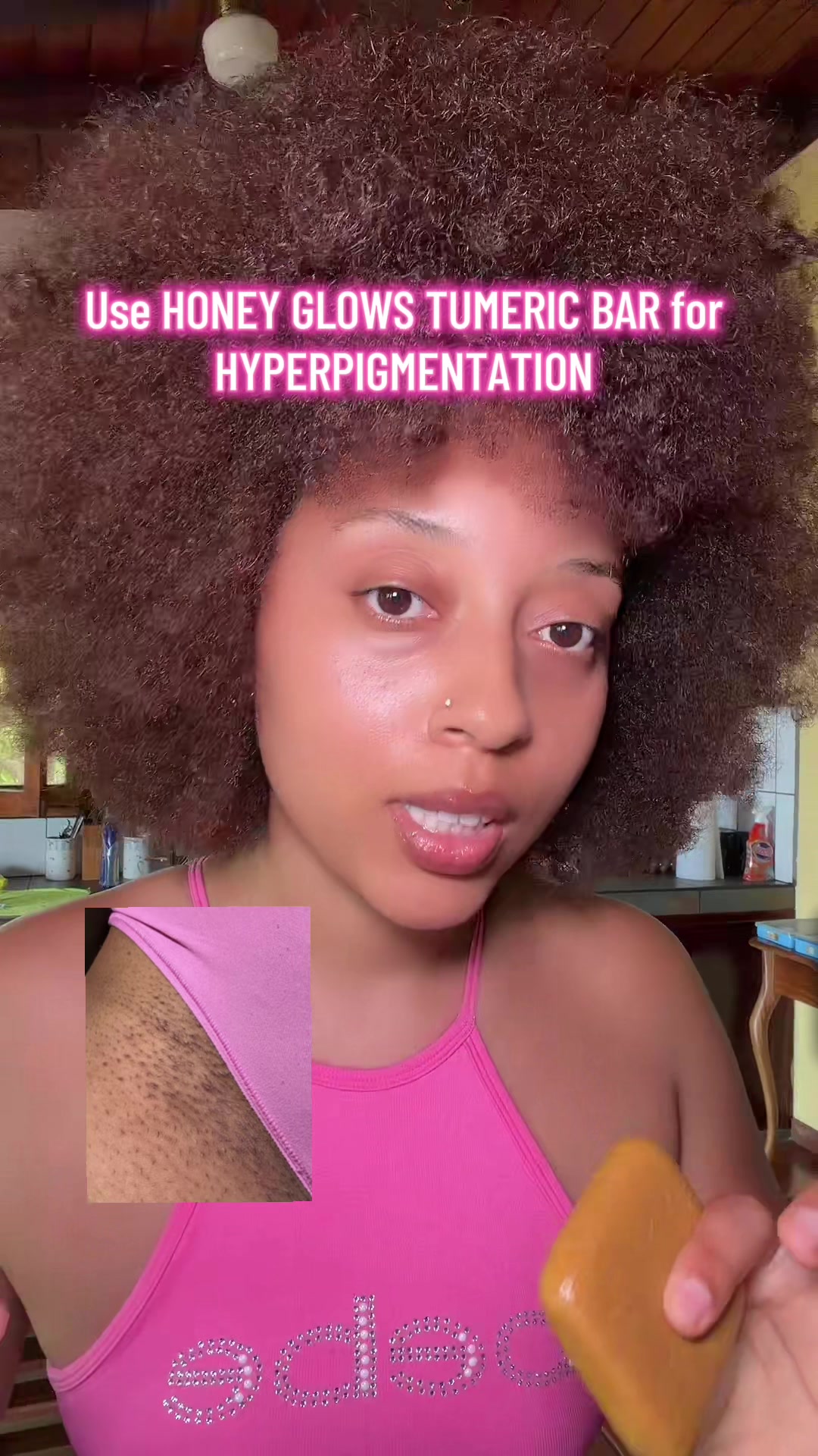 TikTok post by @theroyalcesarstm for Honey Glow. Caption reads: Honey Glows lemon Tumeric and kojic acid [...].