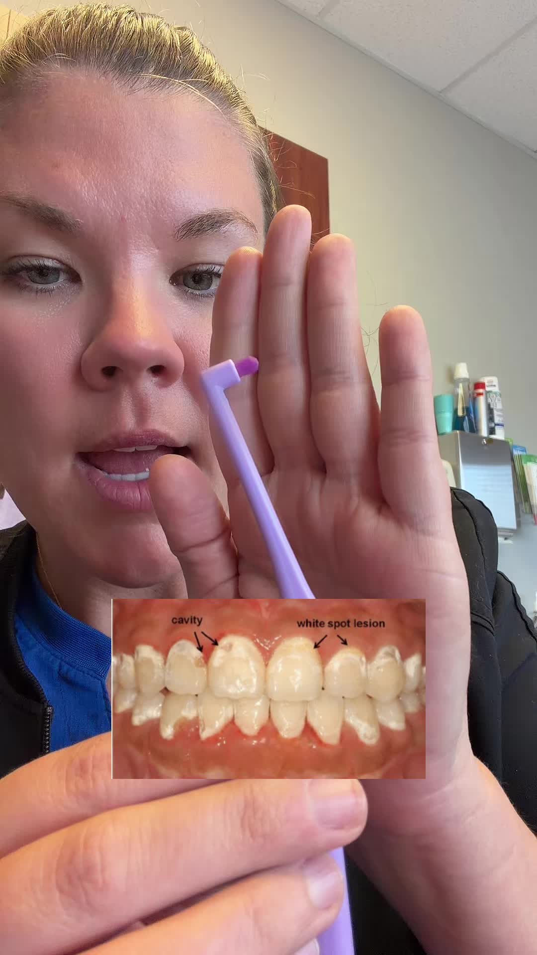TikTok post by @monica_leanne for Ceelike. Caption reads: [...] people in braces… this one is for you!....