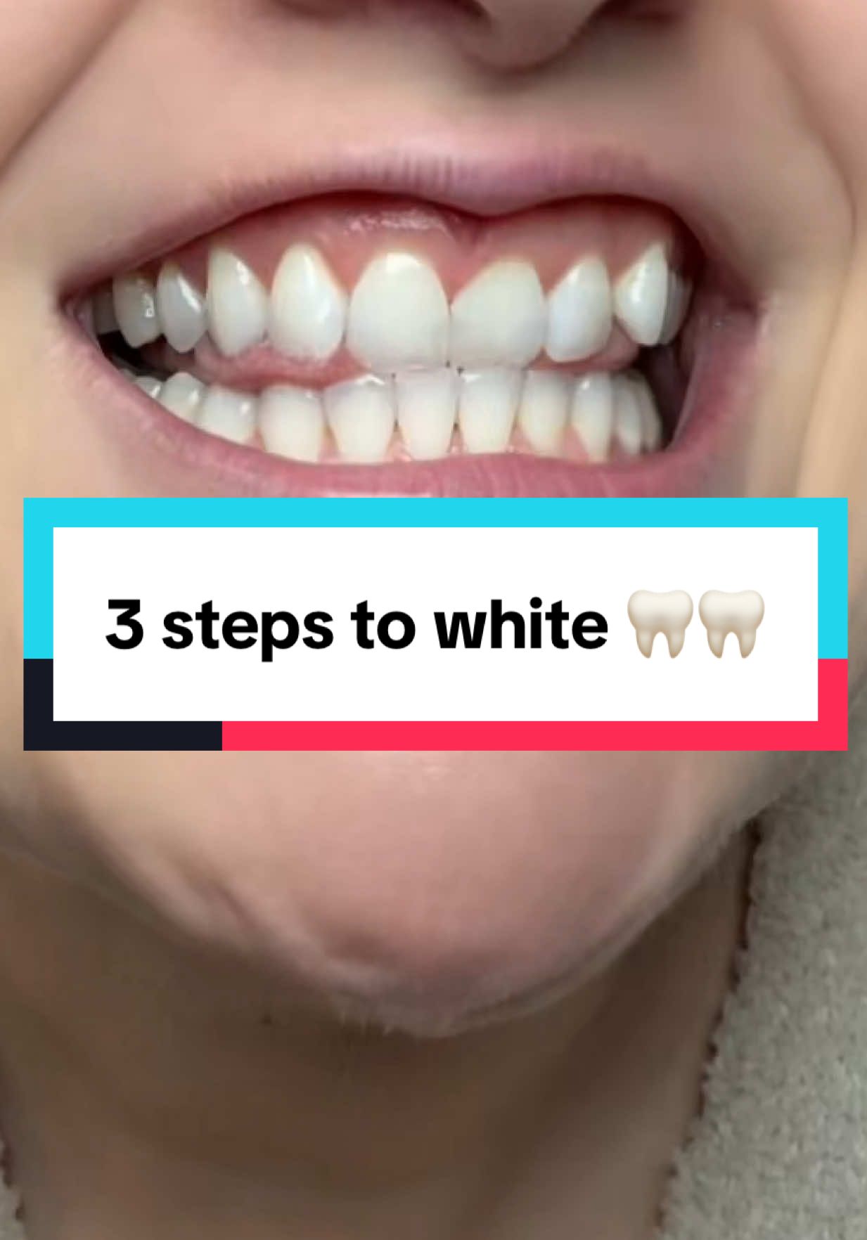 TikTok post by @jenniferokiegal for Boka. Caption reads: 3 steps to white teeth @Boka Oral Care....