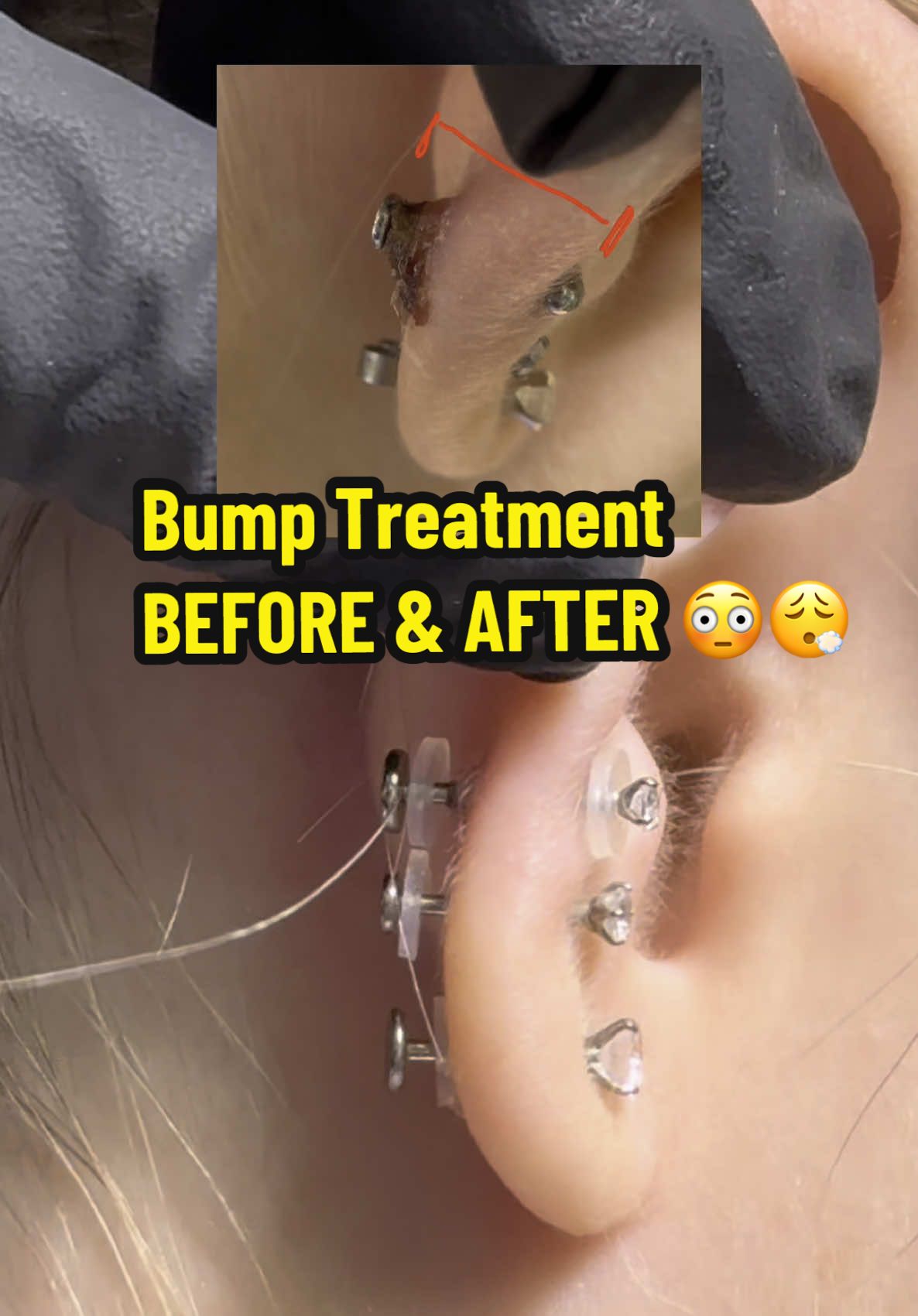 TikTok post by @anamarpiercings for Base Laboratories. Caption reads: [...] her healing journey! Aftercare by @Base....