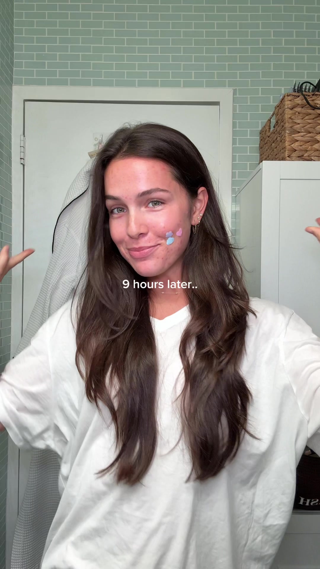 TikTok post by @kylahamlin0 for Grace and Stella Russia. Caption reads: #ad pimple patches that are cute and actually....