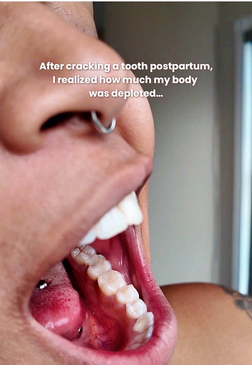 TikTok post by @themicrolocdmom for MaryRuth Organics. Caption reads: I cracked a tooth after pregnancy because my body....