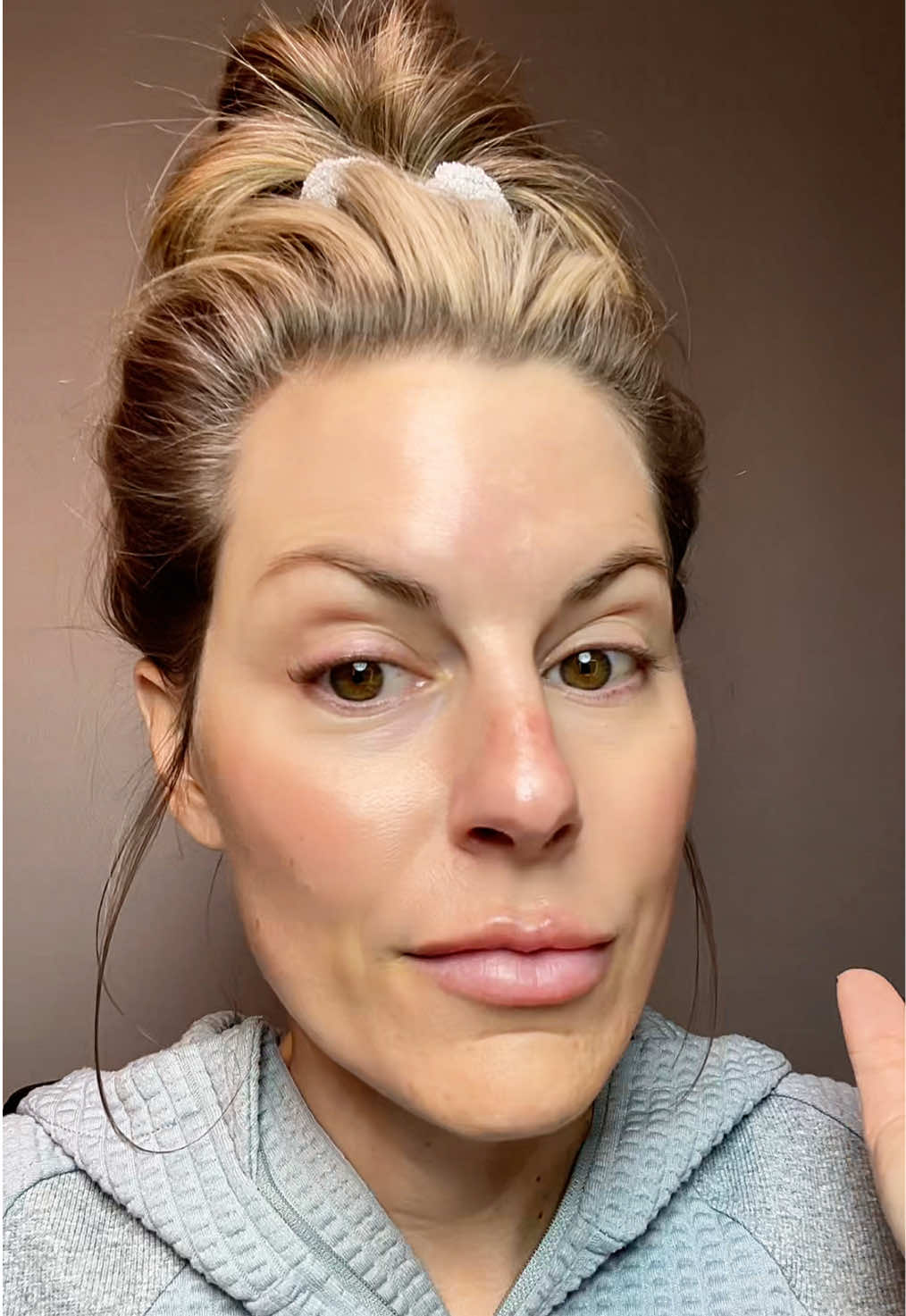TikTok post by @rlew36 for DRMTLGY. Caption reads: [...] #UnderEyeCircles @DRMTLGY.