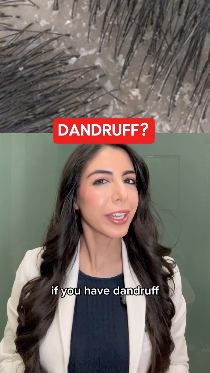 Instagram post by @dr.mina.md for Head&Shoulders. Caption reads: If you have dandruff, look for a shampoo that....