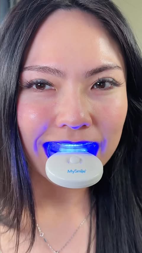 Instagram post by @mysmileusa for MySmile. Caption reads: [...] Non-Sensitive Fast Teeth Whitener from....